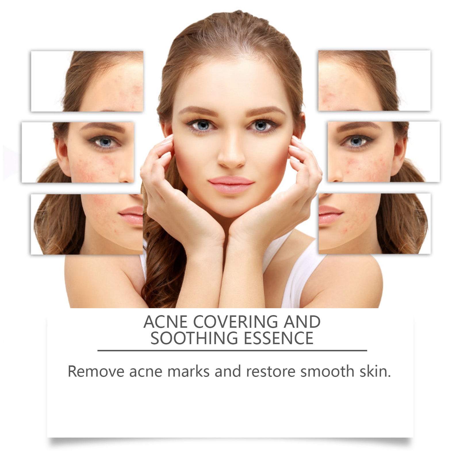 Acne Soothing Hydrating Facial Care Serum